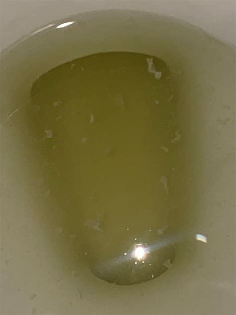 White stuff in my urine !!! | BabyCenter