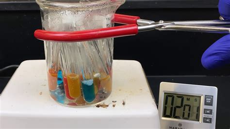 Image result for Benedict Test