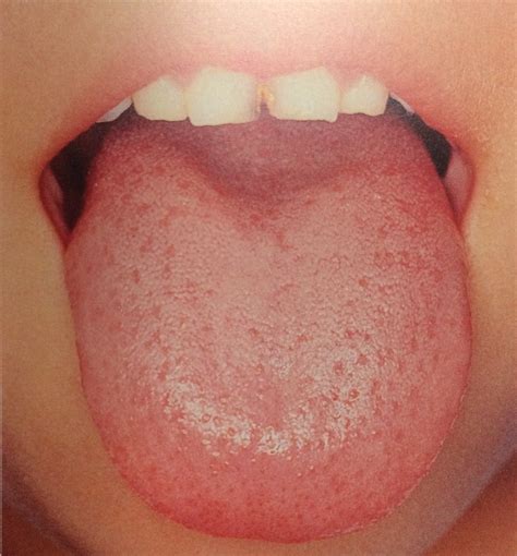 舌診 | 整体・鍼灸なら実績と信頼の「メディカルジャパン新宿」