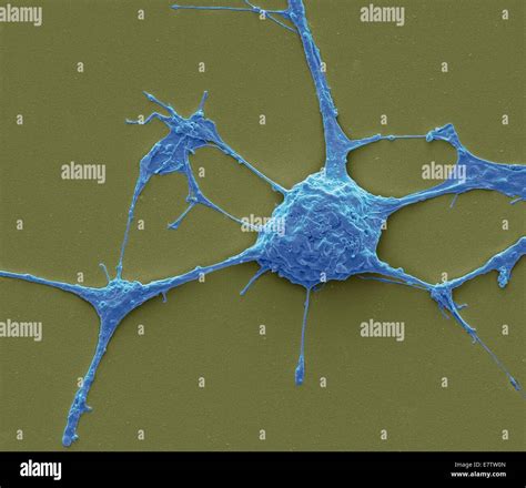 Can You See A Nerve Cell Without A Microscope at Esteban Roder blog