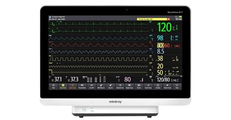 5 Дилеров Mindray BeneVision N17 В РФ - Подборка — Teletype