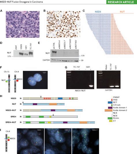 NUT Midline Carcinoma | Semantic Scholar
