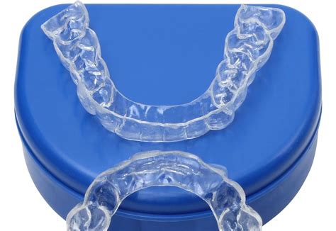 What Is A Retainer After Braces at Katrina Woodard blog