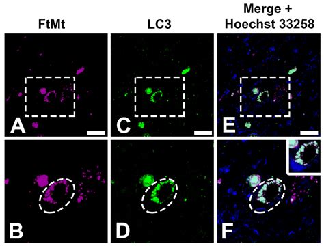 Optimization of 3D Immunofluorescence Analysis and Visualization Using IMARIS and MeshLab