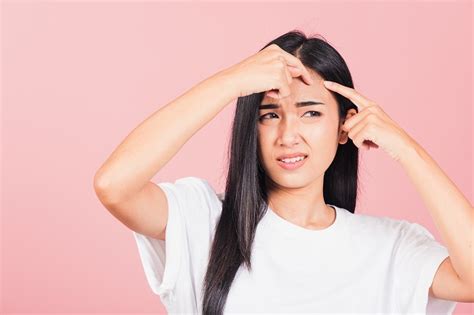 Isotretinoin Oral - Manfaat, Dosis, dan Efek Samping - Alodokter