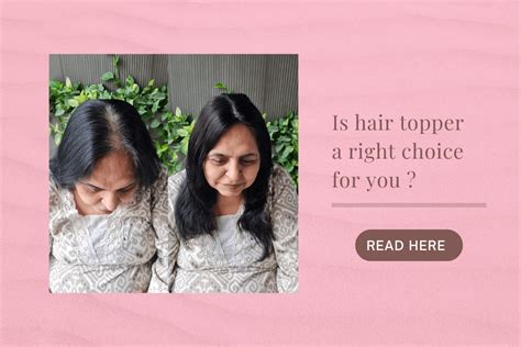 Best Quality Hair Patch | Hair Patch Online - The Gorgeous Hair ...