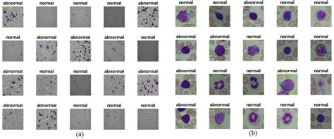 Multi-Method Diagnosis of Blood Microscopic Sample for Early Detection ...