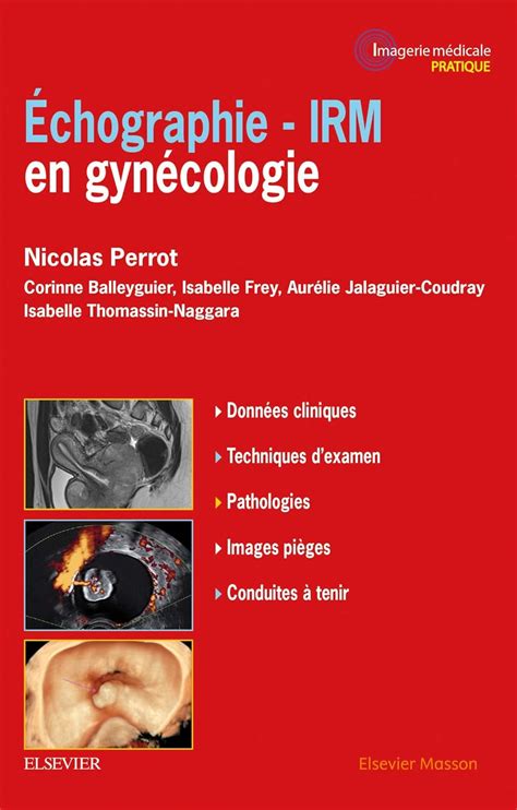 Buy Echographie - IRM en gynécologie: Irm En Gynécologie Book Online at ...