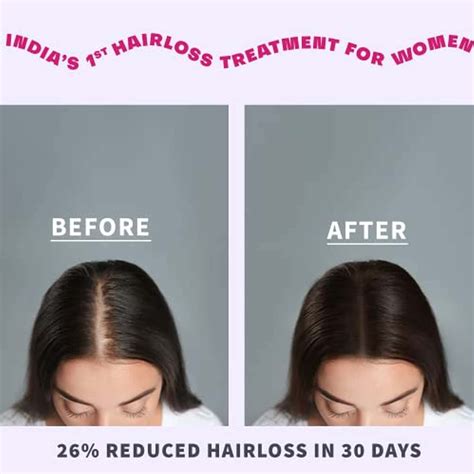 Buy ANVEYA ROOTS BAN THE FALL HAIR OIL-IN SERUM 120ML | FOR HAIR FALL ...