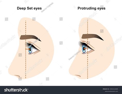 Deep Set Eye