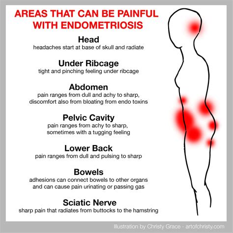 Ovarian cyst vs fibroids understanding the difference – Artofit