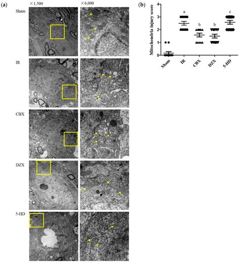 Mechanism of Mitochondrial Connexin43′s Protection of the Neurovascular ...