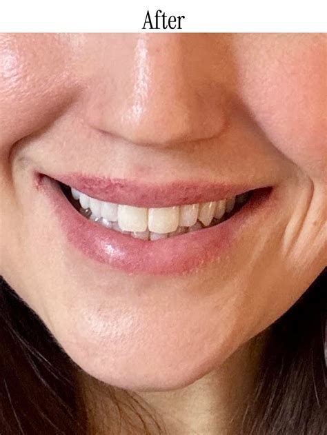 Image result for Best Toothpaste for White Teeth