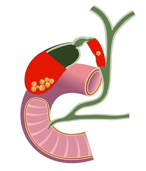 She was blessed for miraculous recovery from Advanced Stage 4 ...