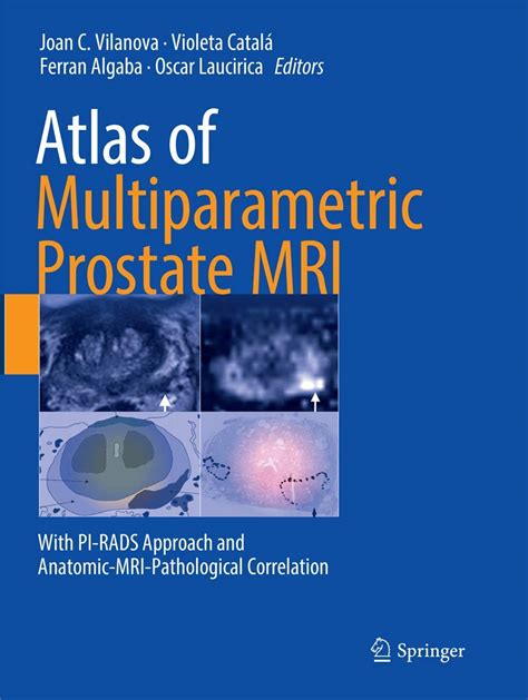 Buy Atlas of Multiparametric Prostate MRI: With PI-RADS Approach and ...