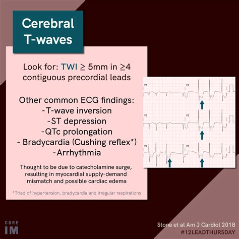 50M has a witnessed cardiac arrest | Core IM Podcast