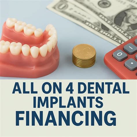 All on 4 Dental Implants Financing: Affordable Smile Solutions - Redent ...