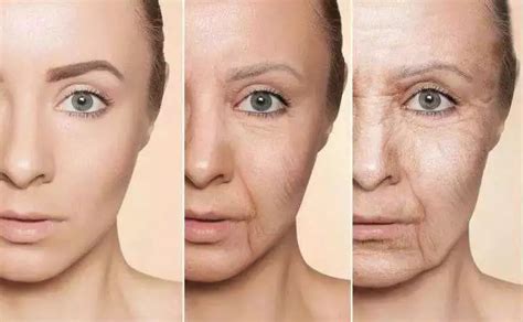 第一道皱纹长在夏天！皮肤科专家推荐「脸部抗皱法」