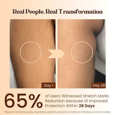 Buy Best Stretch Mark Cream Removal Online by Pokonut