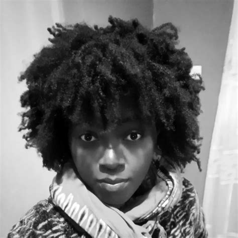 Ultimate Guide To Fixing Dry Scalp On 4C Hair. - NapturallyVal