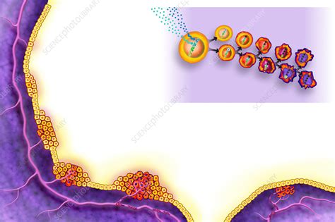 How Is Cancer Caused Animation View 的图像结果