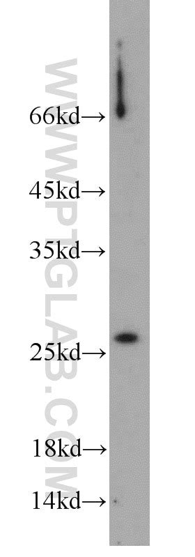 SAR1B antibody (22292-1-AP) | Proteintech