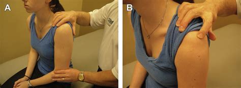 Image result for Sulcus Sign Shoulder