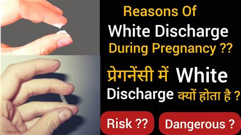 Reasons Of White Discharge During Pregnancy | Pregnancy me White ...