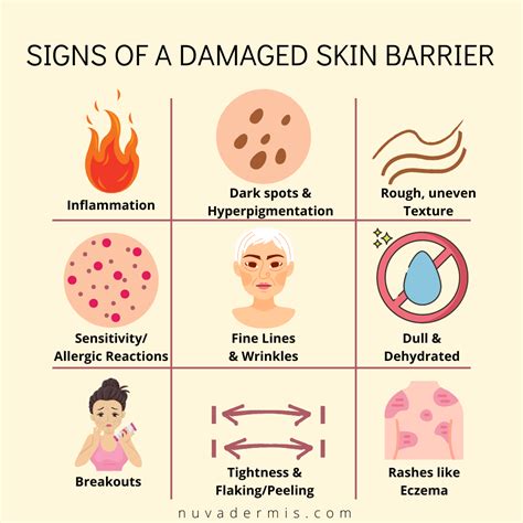 Signs of a damaged skin barrier! | Skin aesthetics, Basic skin care routine, Skin advice
