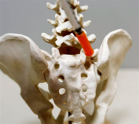 Lower Back Pain Specialist Singapore Care