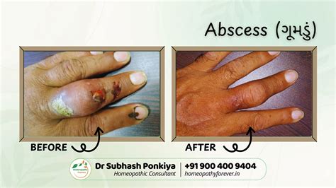 Homeopathy Forever | Best Homeopathic Clinic in Rajkot – Dr. Subhash ...