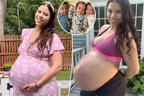 20 Weeks Pregnant With Triplets