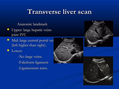 Liver ultrasound | PPT