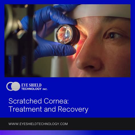 Eye Doctor For Scratched Cornea