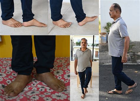 Balance Training 的图像结果