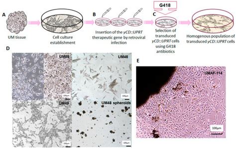 Suicide-Gene-Modified Extracellular Vesicles of Human Primary Uveal ...