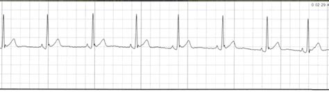 Image result for Telemetry Practice