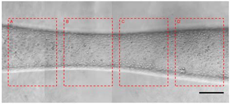 Engineering a Bi-Conical Microchip as Vascular Stenosis Model