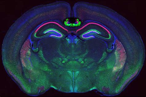 Image result for Neural Development