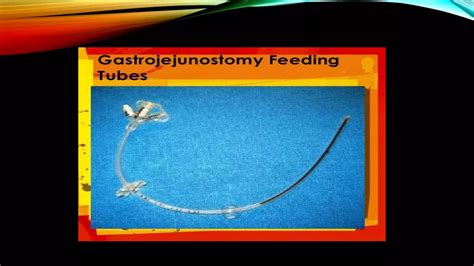 presentation on gastrostomy and jejunostomy feeding | PPTX