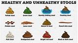 Can you tell the healthy poos from the unhealthy ones? | The Irish Sun