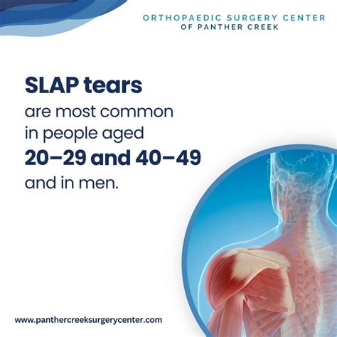 SLAP Tear Surgery: What You Need to Know - Orthopaedic Surgery Center ...