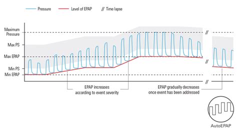 ResMed’s non-invasive ventilators suitable for COPD
