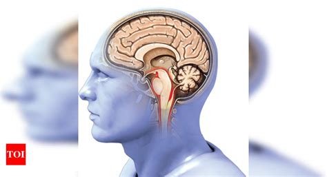 Treatment Of Alzheimer’S Disease: New gene linked to Alzheimer’s ...