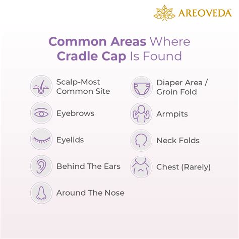 Cradle cap - Symptoms and causes – AreoVeda