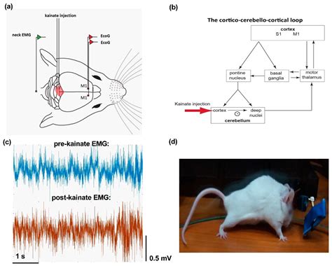 Reduced Interhemispheric Coherence after Cerebellar Vermis Output ...