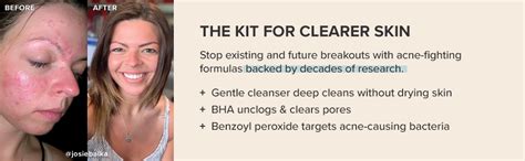 PAULA'S CHOICE CLEAR Pore Normalizing Cleanser, Salicylic Acid Face ...