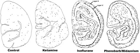 Brain Sciences | September 2013 - Browse Articles