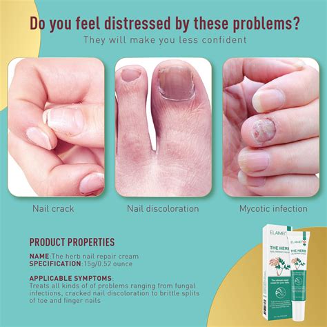 Nail Treatment Fungal Antibacterial Fungisol Antifungal Cream Nail Fungus Fepair Treatment ...