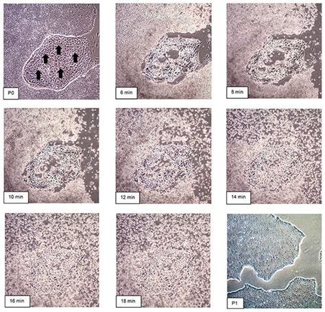 Passaging Human iPS Cells Protocol Using EZ-LiFT™ Reagent